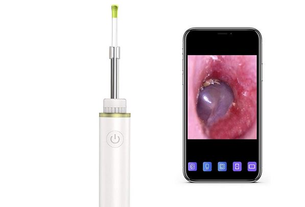 otoscope for iphone 8