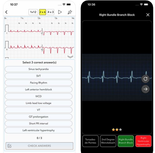 5 Must See iPhone EKG Apps